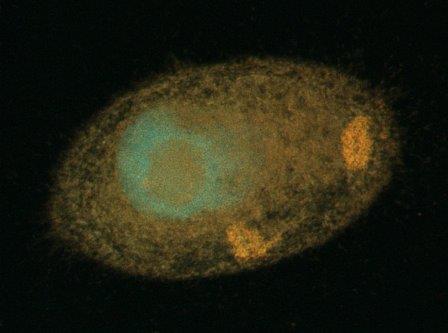 Биологи открыли новый род бактерий внутри клеток инфузорий
