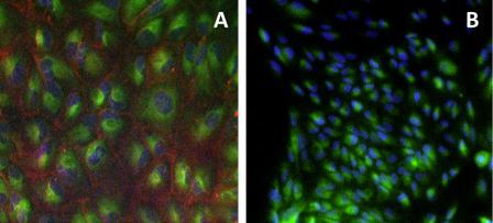 Ученые СПбГУ синтезировали новые реагенты для присоединения флуоресцентных красителей к молекулам живых клеток